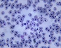 בדיקת רוק לאבחון איידס